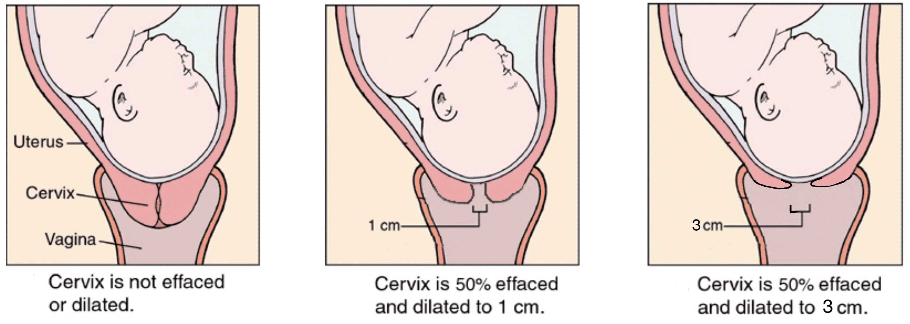 labour-delivery-anthony-siow