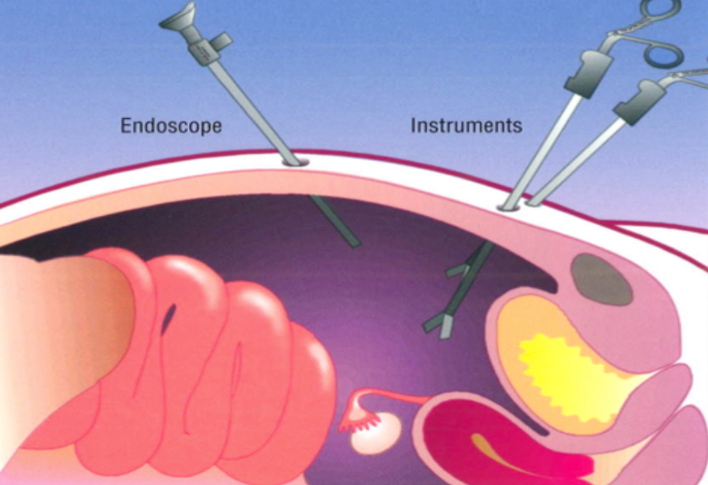 Gynaecology. 