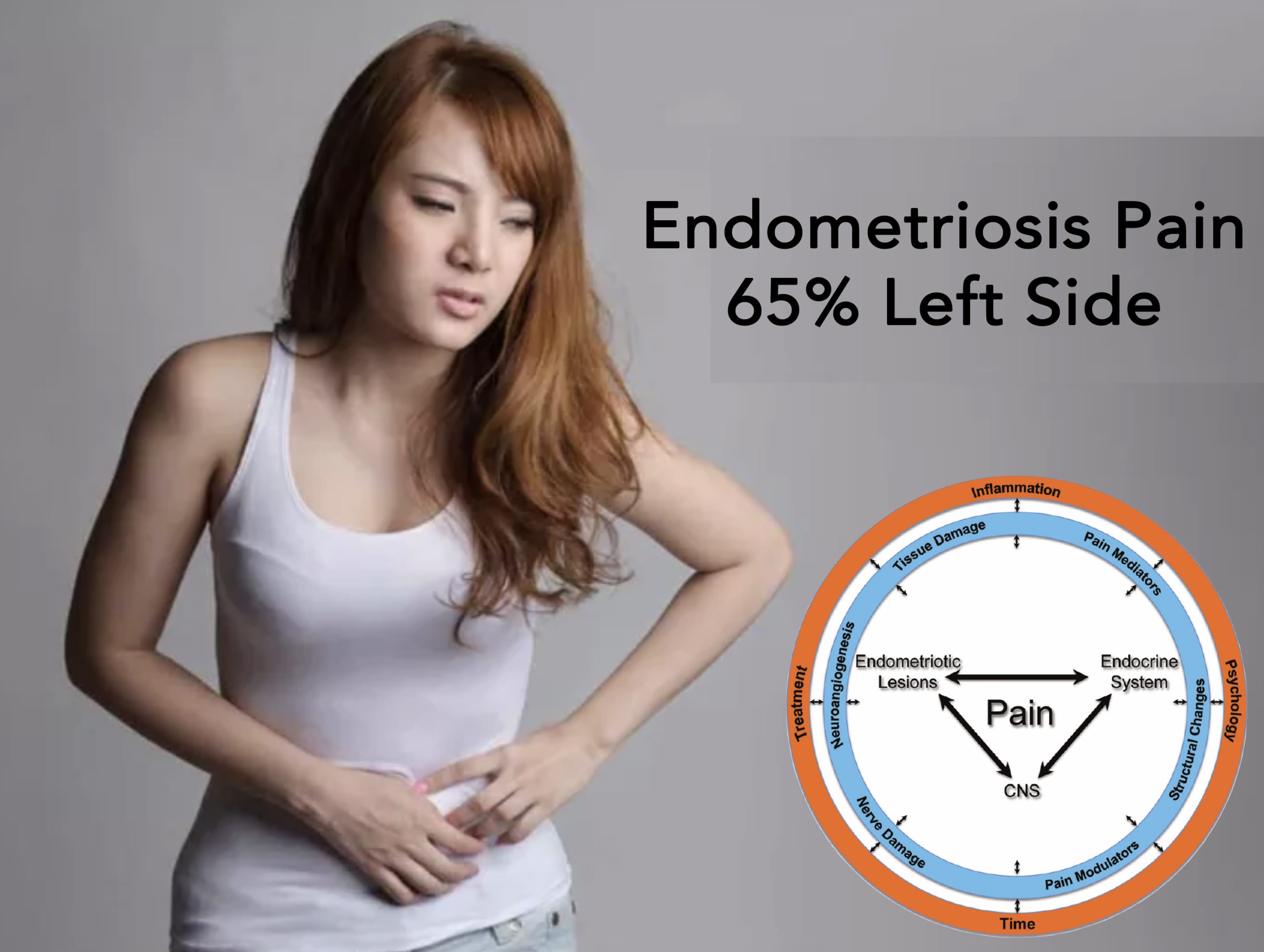 painful-periods-endometriosis-adenomyosis-anthony-siow