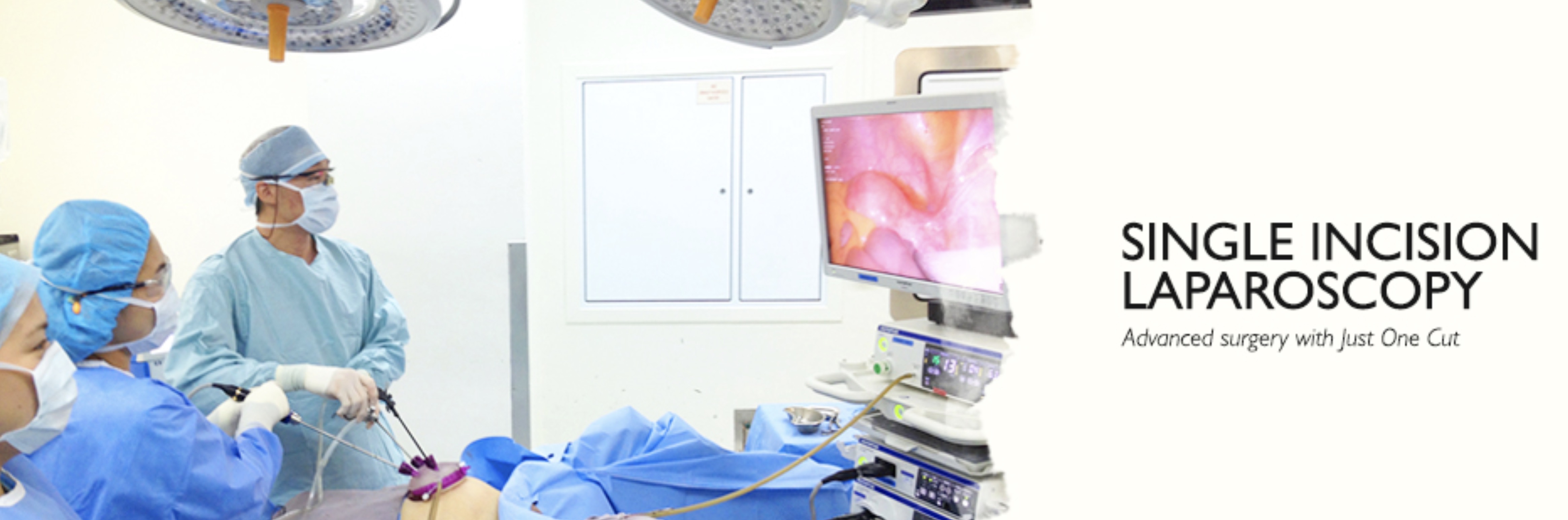 Single Incision Laparoscopy - Anthony Siow