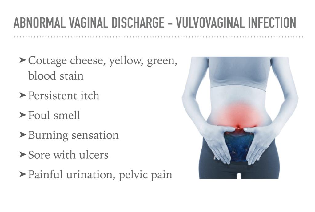 vaginal discharge abnormal