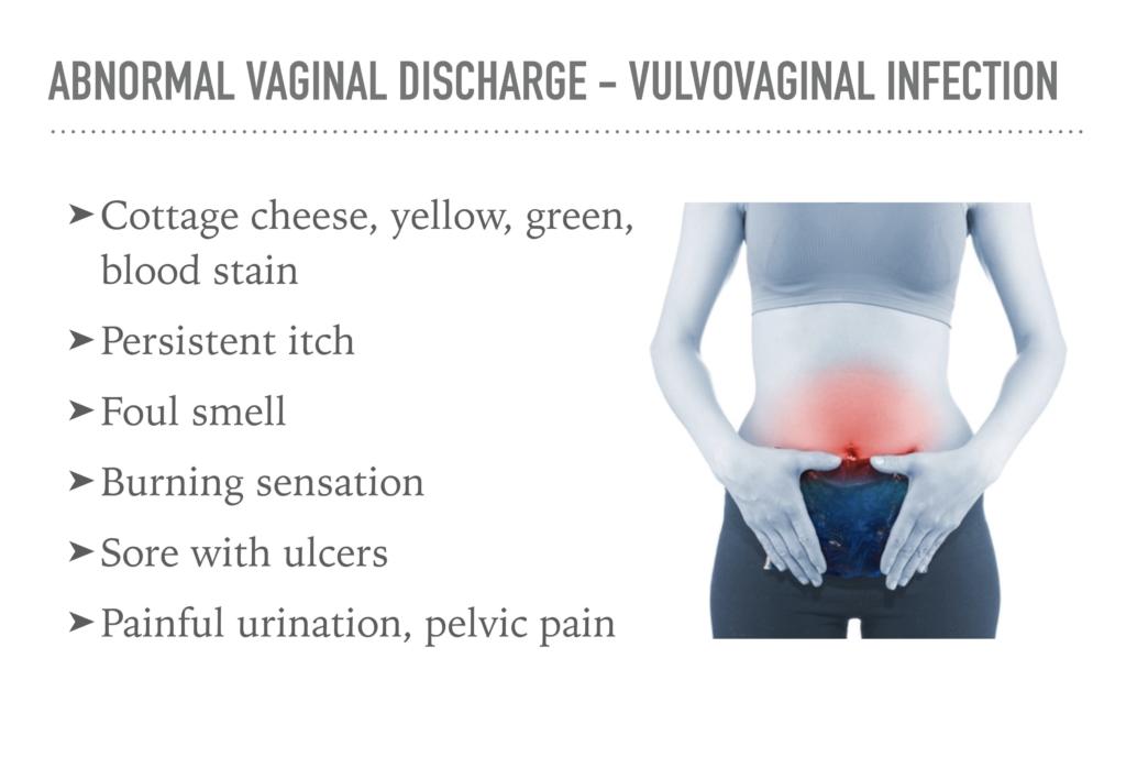 Vaginal discharge, what is normal and abnormal vaginal discharge