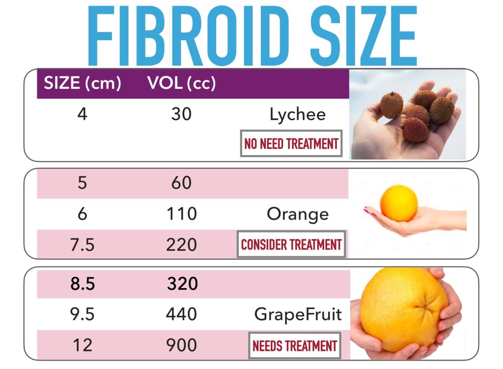 Fibroids Size Chart Uterine Fibroids