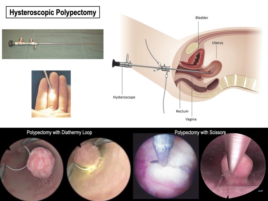 Vaginal Discharge & Itch - Anthony Siow